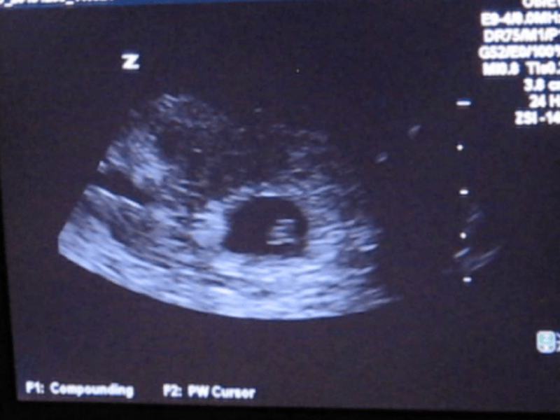 On Disease and Suffering, Pt. I – Reflections on the age old question of how a good God can allow disease and suffering in this&nbsp;world